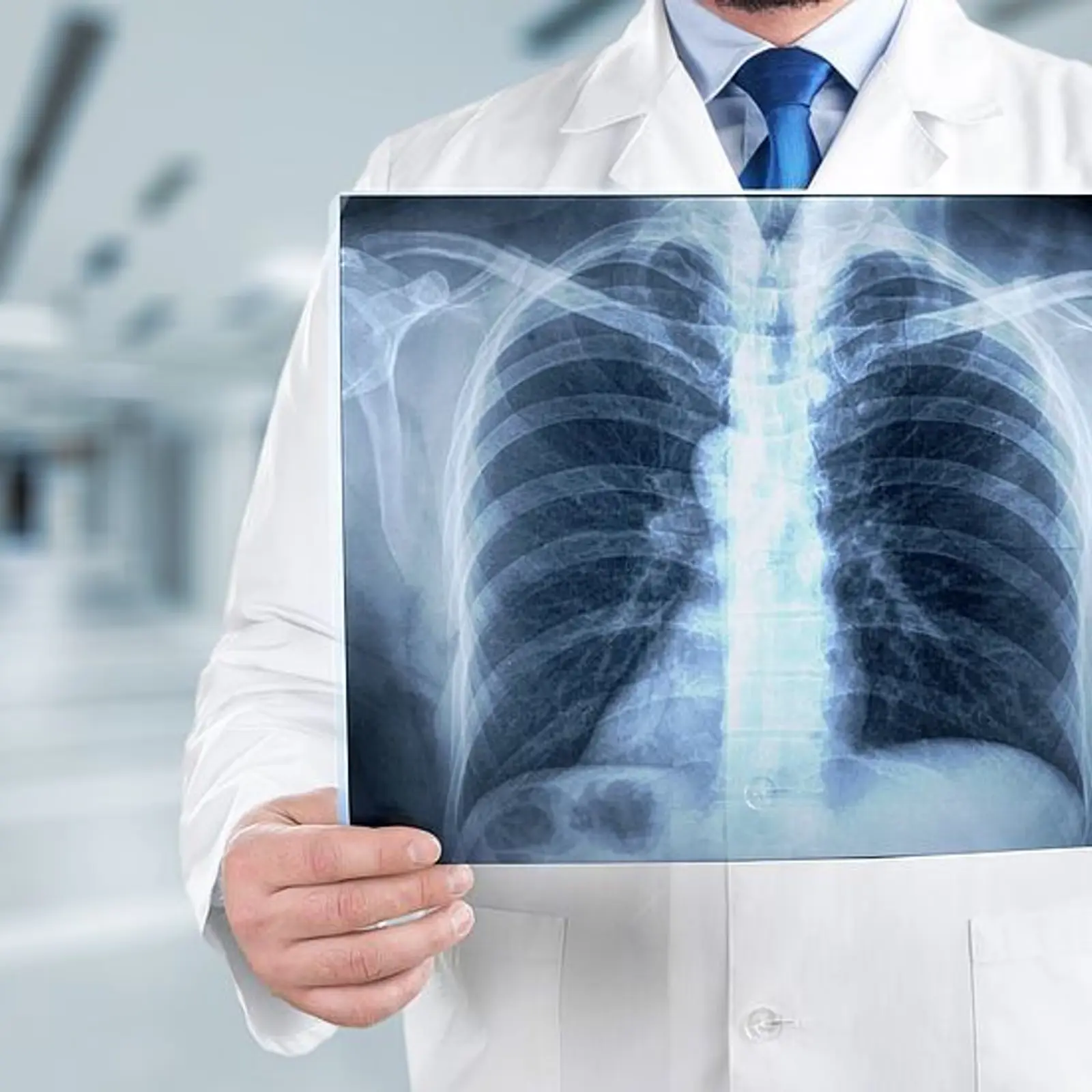 How to Get an X-Ray Without a Referral