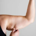 How to lose arm fat: Effective tips and exercises