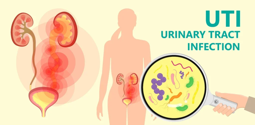 How to get rid of a UTI in 24 hours