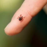 How to remove a tick from a human without tweezers